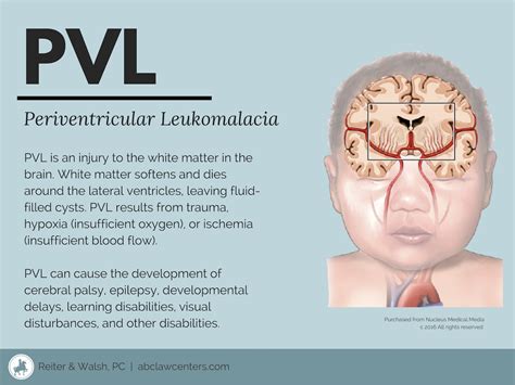 pvl medical abbreviation infection